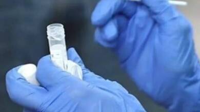 Argentina impulsa un método para detectar maltrato infantil a través de la salivaArgentina impulsa un método para detectar maltrato infantil a través de la saliva