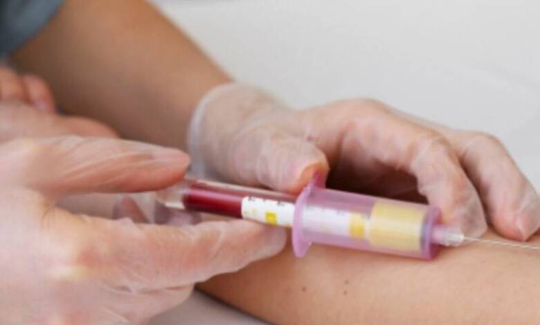 Un análisis de sangre puede detectar cáncer hasta tres años