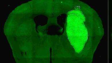 Científicos del CONICET frenan el avance de un cáncer cerebral con estudios preclínicos