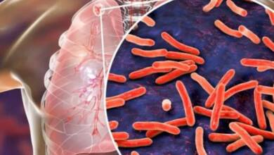 El CONICET desarrolló un método rápido, económico y sin cultivo para diagnosticar tuberculosis