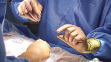 Trasplantaron por primera vez un pulmón de cerdo a un hombre