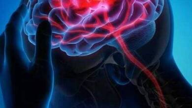 Lograron revertir el daño cerebral de un ACV con células madre