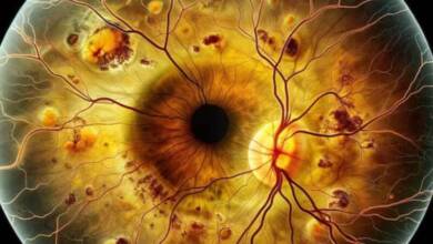 Médicos argentinos ganaron el “Óscar de la retina” por una cirugía revolucionaria