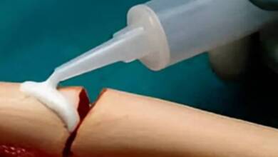 China desarrolla un pegamento de huesos biodegradable que repara fracturas en minutos