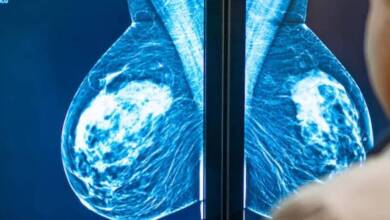Una provincia argentina indicará mamografías desde los 40 años