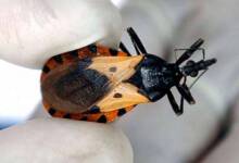 Un test argentino permitirá detectar el Chagas desde el nacimiento