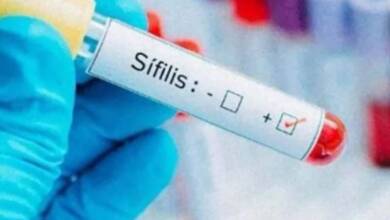 Preocupación por el aumento de casos de sífilis en Argentina