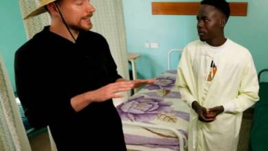 MrBeast impulsó un operativo médico que permitió financiar mil cirugías en Kenia