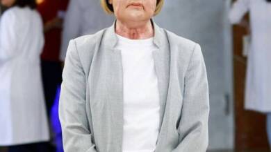 Realizaron el primer trasplante facial a partir de una donante fallecida