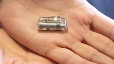 Implantan el marcapasos más pequeño del mundo a una bebé