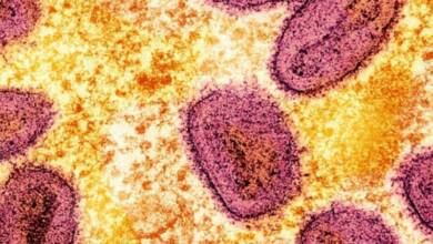 Detectan en Argentina el primer caso de viruela del mono