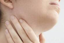 Expertos advierten sobre un aumento de casos de papera