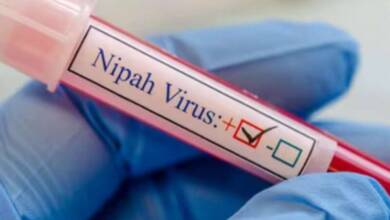Japón avanza con la primera prueba en humanos de una vacuna contra el virus Nipah