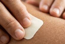 Desarrollan un parche térmico capaz de reducir el melanoma para la lucha contra el cáncer de piel