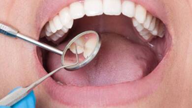 Encontraron una molécula que elimina la placa que causa caries